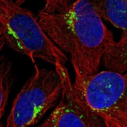 FAM207A Antibody, Novus Biologicals 0.1mL; Unlabeled:Antibodies, Polyclonal